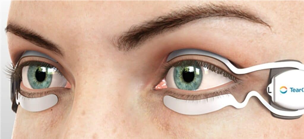 Illustrated closeup of the TearCare system working on a person's eyes